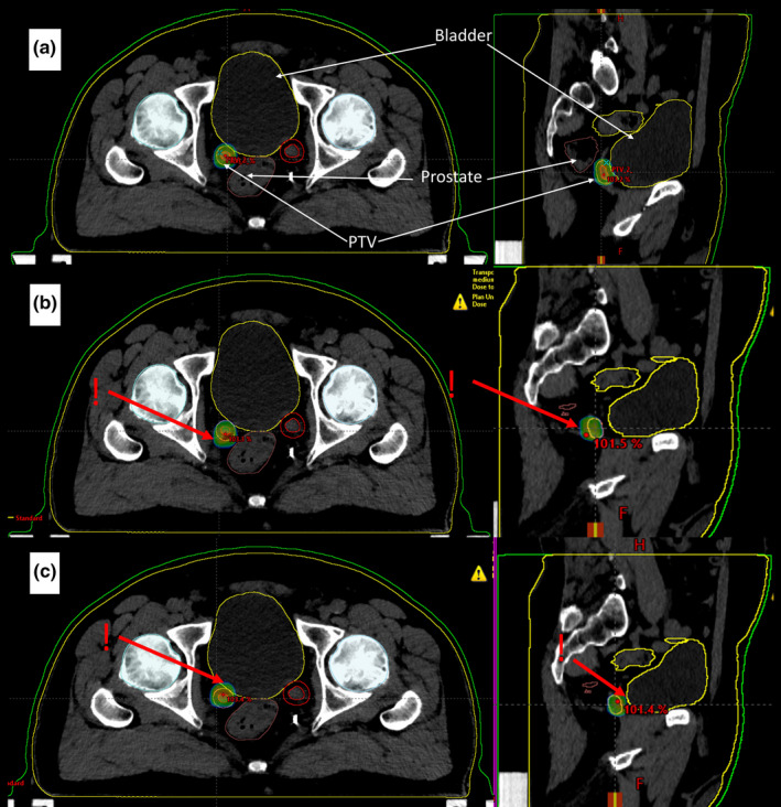 FIG. 1