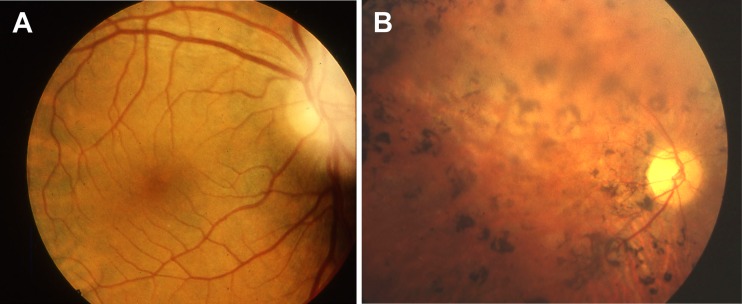 Fig. 2