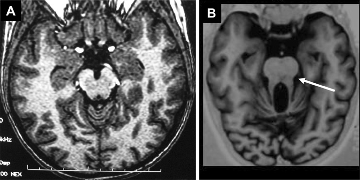 Fig. 3