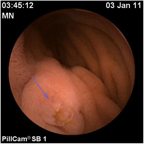 Figure 13