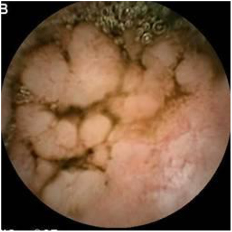 Figure 14