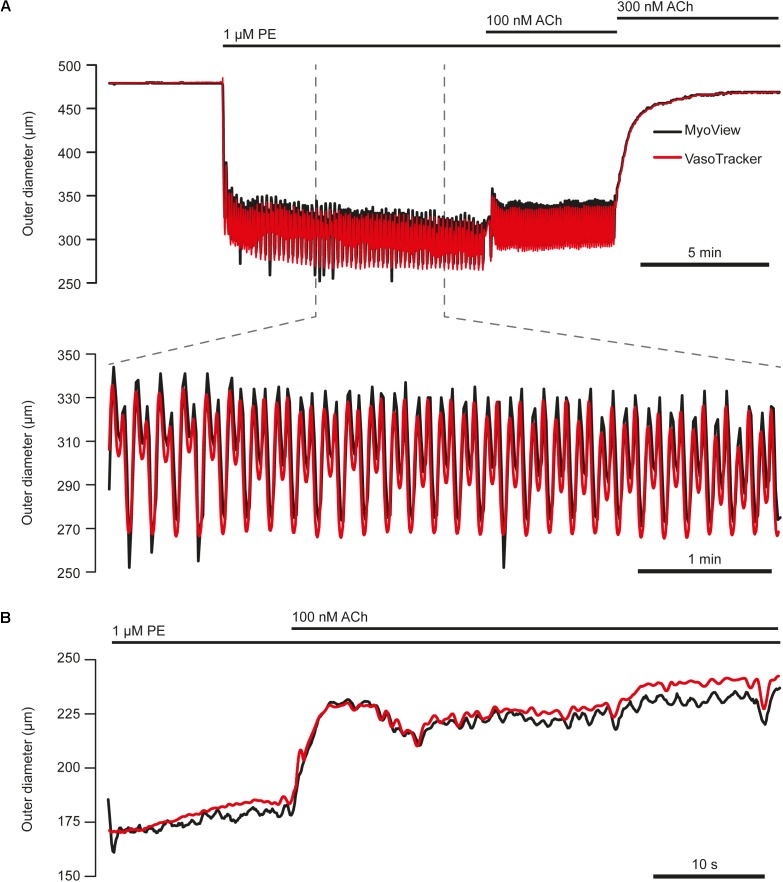 FIGURE 11