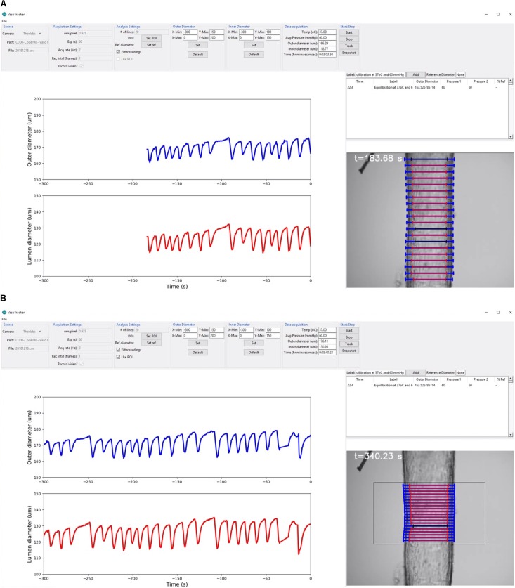 FIGURE 4