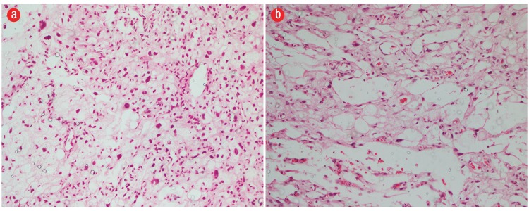 Correlation Of Intraoperative Frozen Section Report And