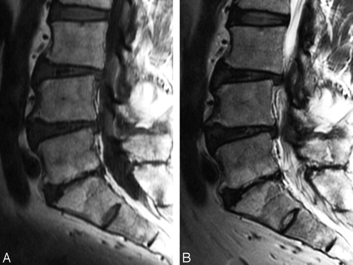 Fig 2.