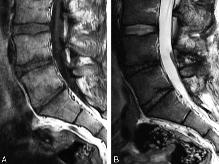 Fig 3.