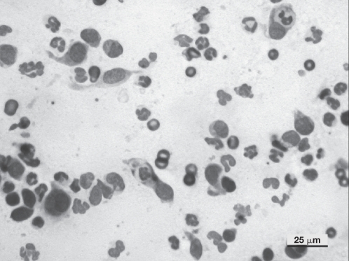 Cutaneous sterile pyogranuloma/granuloma syndrome in a dog - PMC