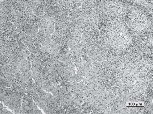 Cutaneous sterile pyogranuloma/granuloma syndrome in a dog - PMC