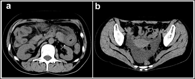 Fig.1