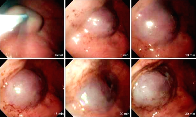 Fig. 3