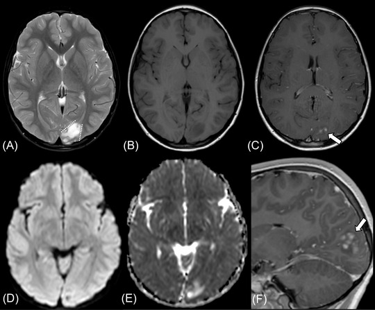 FIGURE 4