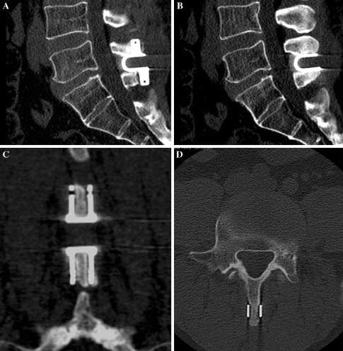 Fig. 2