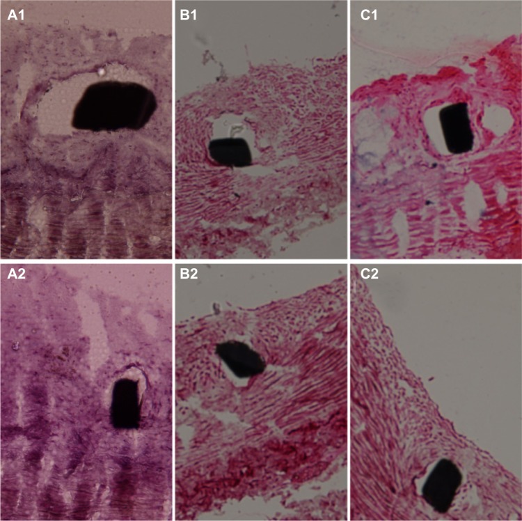 Figure 11