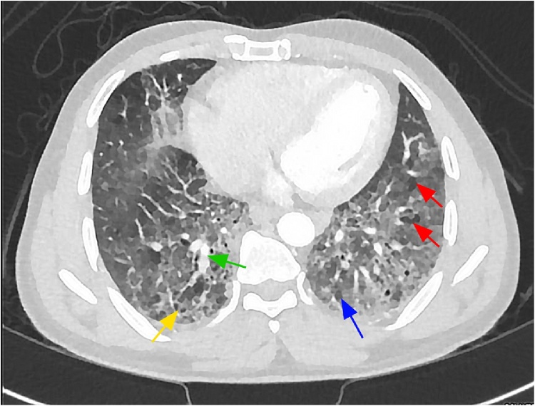 Fig. 2