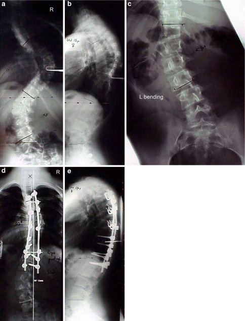 Fig. 4