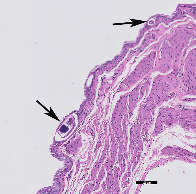 Fig. 12