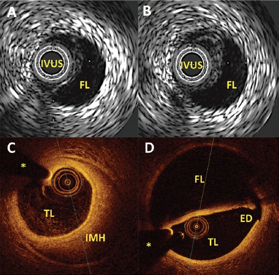 Figure 3: