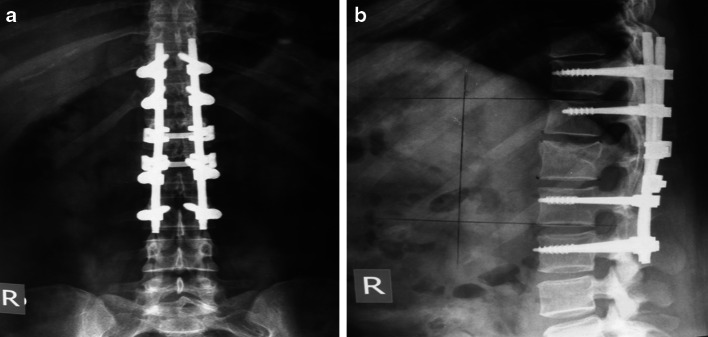 Fig. 2