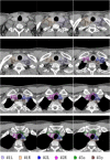 Fig. 13.