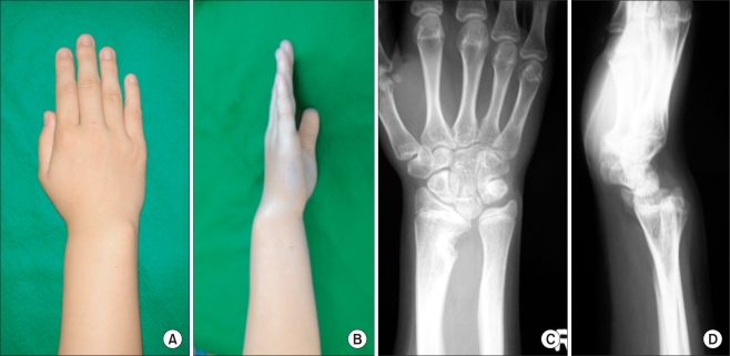 Fig. 13