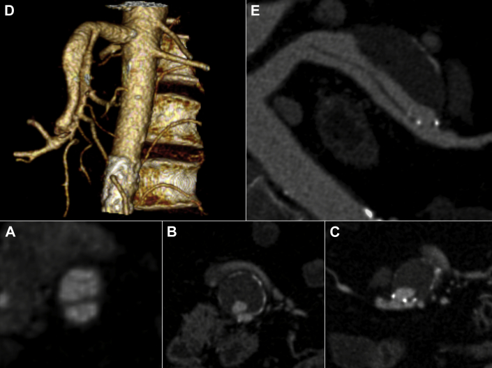 Fig 1