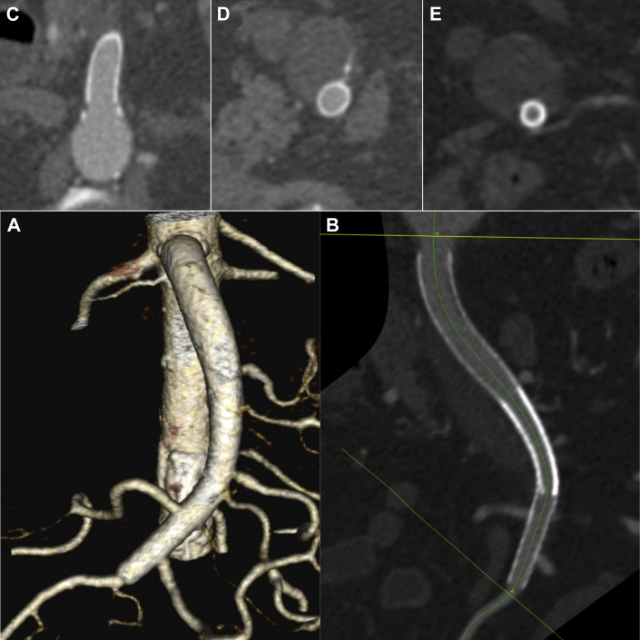 Fig 3