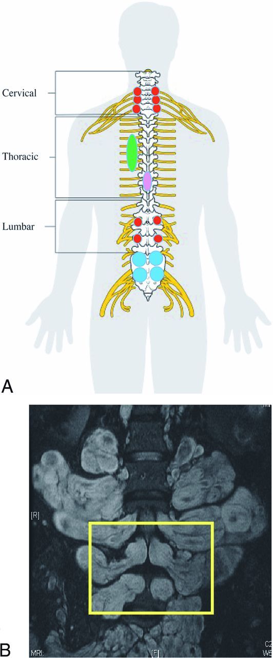 Fig 2.