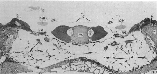 Fig. 10