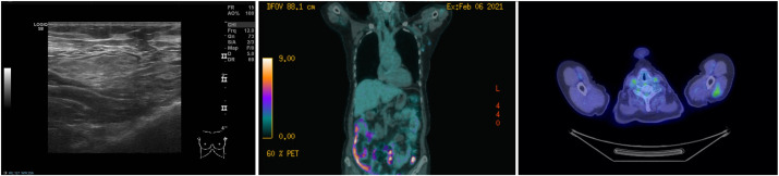 Fig. 5