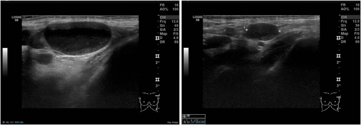 Fig. 4