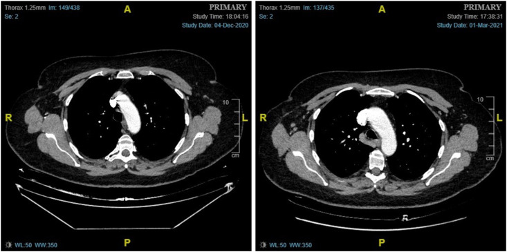 Fig. 6