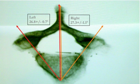 Fig. 2