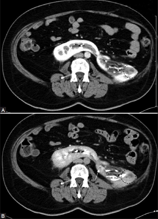 Figure 3 (A, B)