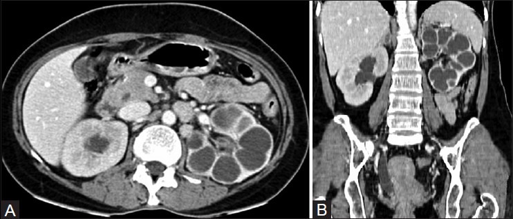 Figure 12 (A, B)