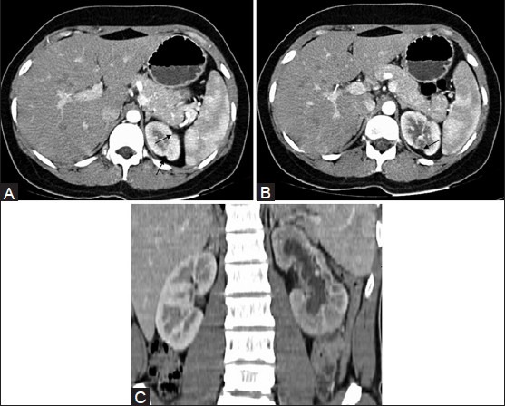 Figure 7 (A-C)