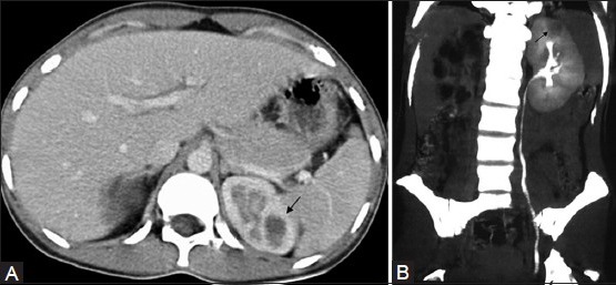 Figure 4 (A, B)