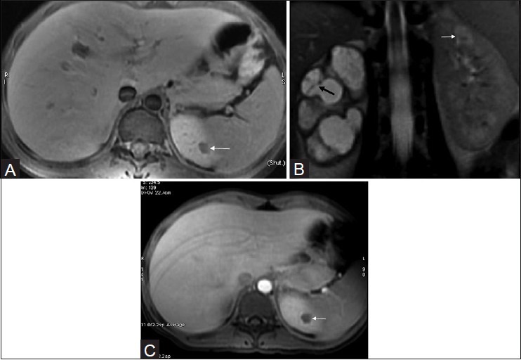 Figure 18 (A-C)