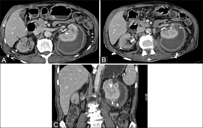 Figure 1 (A-C)