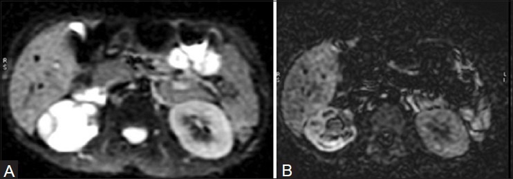 Figure 22 (A, B)