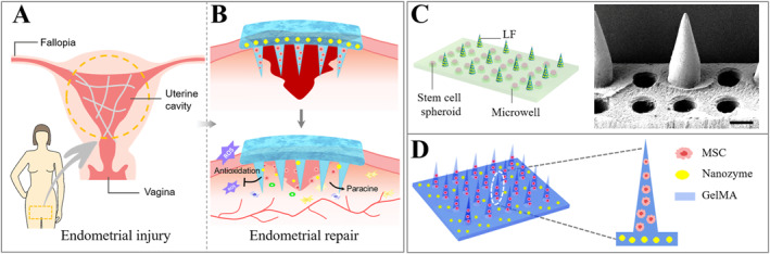 FIGURE 11