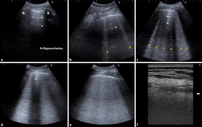 graphic file with name 10049_2020_767_Fig4_HTML.jpg
