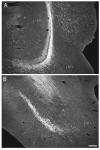 Fig. 11
