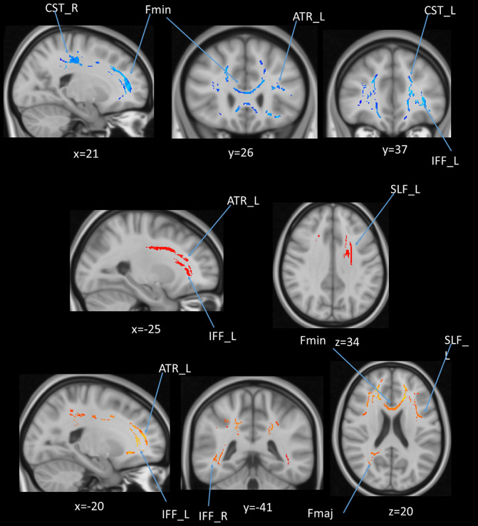 Figure 10