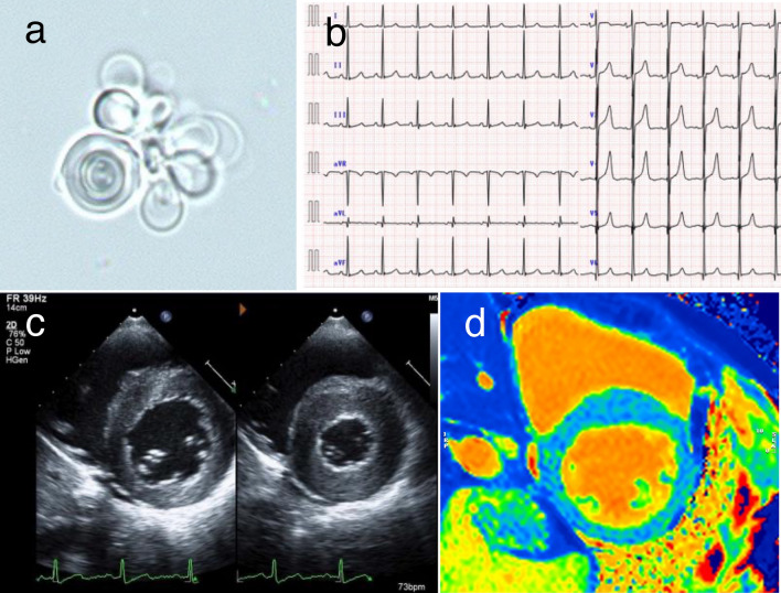 Fig. 1