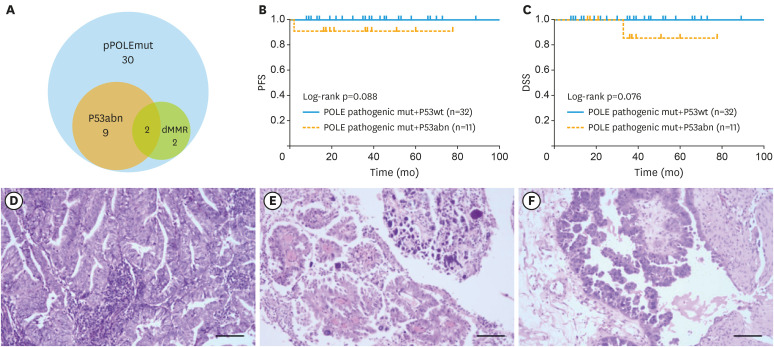 Clinicopathological And Molecular Characterization Of High-grade 