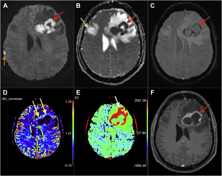 Fig. 1