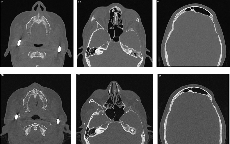 Fig 5