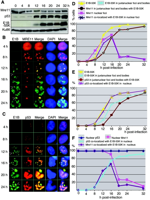 FIG.4.