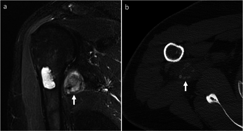 Fig. 11