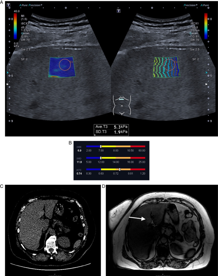 Figure 4